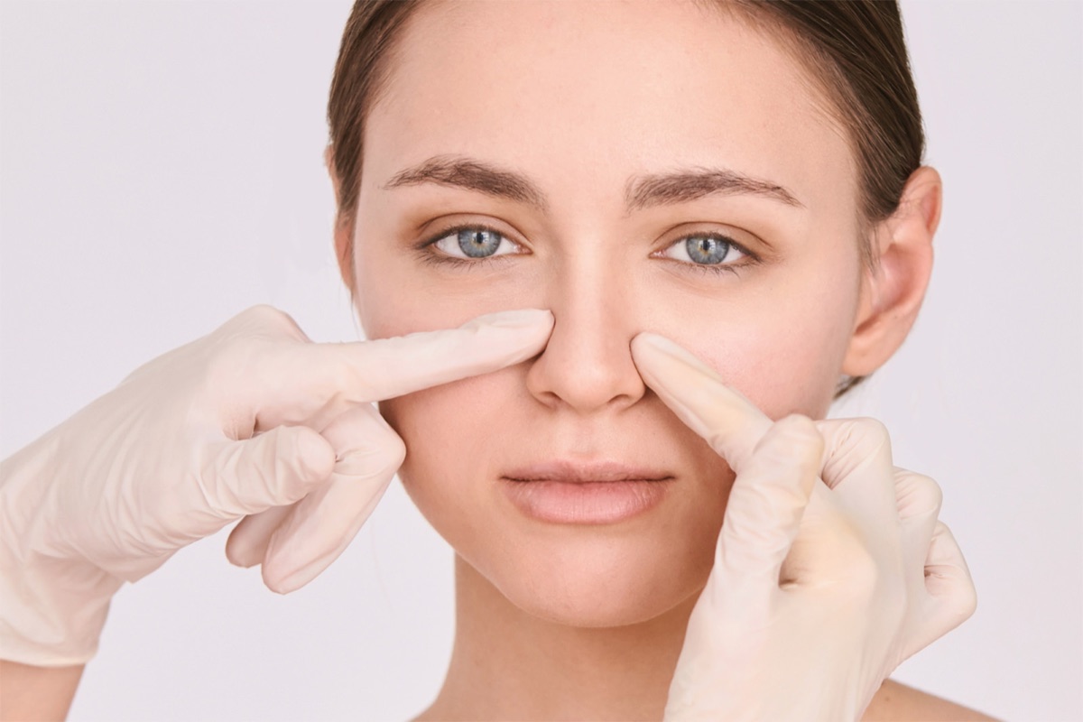 Harmonisation du profil nasal — fils Aptos