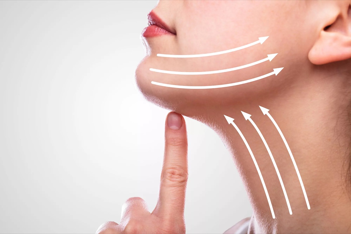 Micro-lipoaspiration du cou